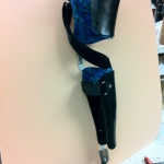 Knee ankle foot orthosis, side view
