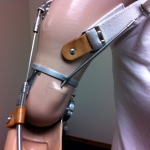 Trans-humeral prosthesis, body powered elbow