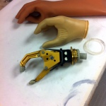Internal view of myoelectric prosthetic hand, with cosmetic cover.