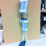 Custom leg brace with straps, side view