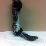 Carbon fiber ankle foot orthosis, side view
